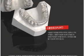 [2016. 03. 01.~03. 31.] 제 1회 턱관절 스플린트 무료 치료 지원